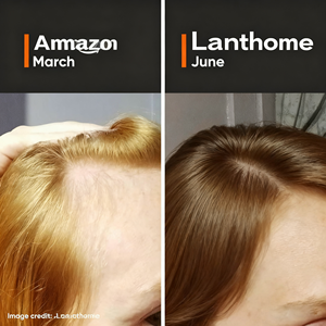 OEM 18% Haardensiteitserum Haaruitvalbestrijding Vegan Procapil Capixyl Redensyl Anagain Baicapil Peptiden Vitamine C Haarserum - Product Image 4