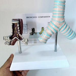 Modelo Comparativo de Tráquea Humana Saludable y Tráquea Dañada por el Tabaco - Product Image 3