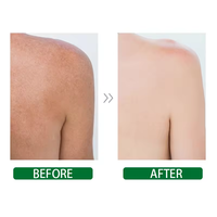 Masque d'argile indienne végétalienne à marque privée 100% naturelle à base de bentonite de calcium pour le nettoyage des pores, vente en gros