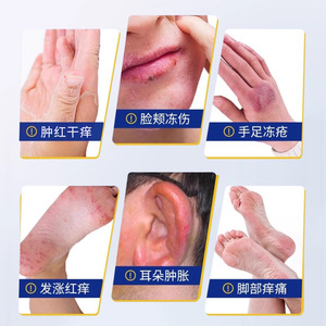 Crème hydratante anti-gerçures pour les mains et les pieds, usage général, pour peaux sèches - Product Image 3