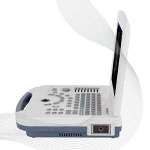 Longermay Ecógrafo Veterinario de Tableta a Color Portátil Máquina de USG Escáner de Ultrasonido Portátil Totalmente Digital en B/N para Humanos - Product Image 3