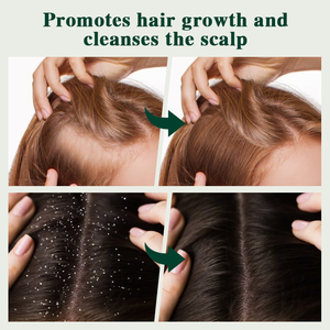 Private Label Oem Natuurlijke Ui Biotine <span class=keywords><strong>Massage</strong></span> <span class=keywords><strong>Spa</strong></span> Rozemarijn Haarverzorging Anti Roos Exfoliator Haar Hoofdhuid <span class=keywords><strong>Scrub</strong></span> Set - Product Image 6