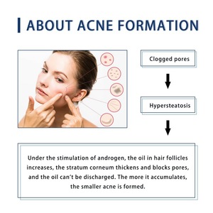 Lotion antibactérienne Hoygi pour estomper l'acné, nettoyage du visage, réparation des cicatrices, traitement des boutons et des cicatrices profondes, lotion douce - Product Image 3