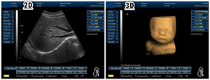 Appareil d'échographie portable électrique en plastique noir et blanc, système de diagnostic de type ordinateur portable 3D - Product Image 2