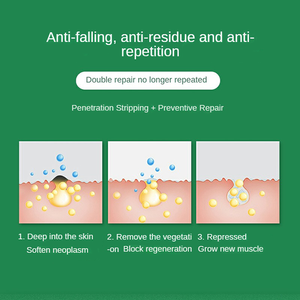 2 In 1 Huid Anti Jeuk Crème En Spray Psoriasis Dermatitis Huiduitslag <span class=keywords><strong>Vagina</strong></span> Verwijderen Vrouwen/Man Jeuk Zalf - Product Image 5