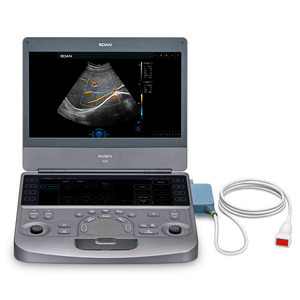 Échographe Doppler Couleur Portable Haute Performance Edan AX8 pour Usage Humain - Product Image 2