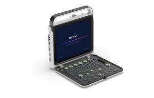 BMV BPU60C Máquina de ultrasonido veterinario 3D/4D Doppler a color B/W Imágenes USB Recargable CE Certificado Clase II Monitor de 2 años - Product Image 4