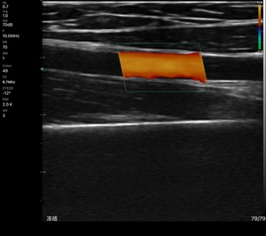 Máy Quét Siêu Âm USB WIFI Siêu Âm Cầm Tay Không Dây Đầu Dò Tuyến Tính - Product Image 3