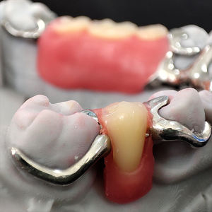 Échantillon gratuit Prothèses dentaires partielles amovibles Chine Laboratoire <span class=keywords><strong>dentaire</strong></span> Impression 3d Co Cr Alliage Cadre métallique - Product Image 1