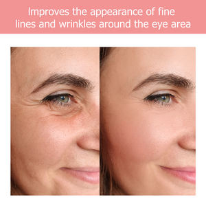 תמצית חומצה היאלורונית הנמכרת ביותר משפרת את לחות העור, פפטידי קולגן, תוסף תזונה נוזלי לשימוש דרך הפה. - Product Image 6