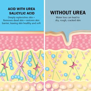 Crema para Pies Intensamente Hidratante <span class=keywords><strong>con</strong></span> Urea y Ácido Salicílico al 2% para Piel Seca, Agrietada, Áspera y <span class=keywords><strong>con</strong></span> Textura Irregular - Product Image 6