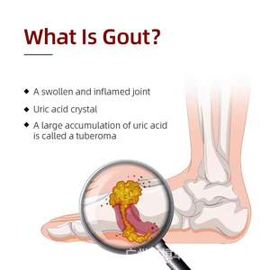 Spray para el dolor y las molestias articulares en la cintura, piernas, rodillas, cuello y hombros - Product Image 5