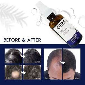 Spray para el Cabello de Efecto Rápido a Base de Hierbas OEM, Fórmula <span class=keywords><strong>2</strong></span> en 1 con Escualano, Formato Líquido Unisex, Modelo 003 para Adultos - Product Image 2