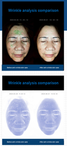 New Arrival Reasonable Price Skin Elasticity Analyzer Facial Skin Analyzer Face Analyser Machine Face Scanner Skin Analyzer - Product Image 6