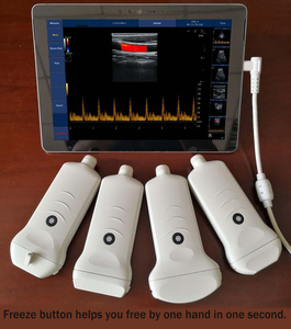 Ecógrafo Doppler Color Portátil para <span class=keywords><strong>Tiroides</strong></span> <span class=keywords><strong>de</strong></span> Alta Resolución y Eficiencia con Certificación CE e ISO - Product Image 3