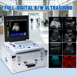 Máquina <span class=keywords><strong>de</strong></span> Ultrasonido Médica Portátil en Oferta, <span class=keywords><strong>Precio</strong></span> Bajo, Imágenes en Blanco y Negro, Sonda Dual Convexa Lineal, Veterinaria y Humana - Product Image 4
