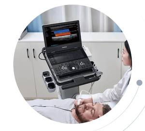 Échographe mobile SonoScape X10/E10 sur chariot, machine à ultrasons noir et blanc avec 3 sondes/système d'échographie vétérinaire - Product Image 4