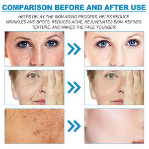 Venta caliente Etiqueta Privada suero facial orgánico reafirmante hidratante vitamina B5 suero con ácido hialurónico 30ml - Product Image 2