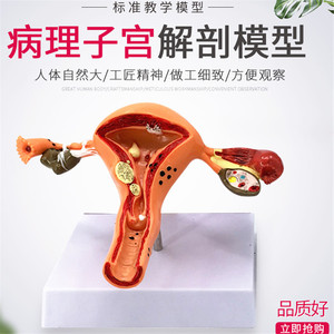 Sistema reproductor femenino humano: modelo anatómico y patológico del útero, la vagina y los ovarios; material didáctico para - Product Image 3