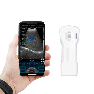 Ecografo Portatile Elettrico SURESULT D3Ultra per Imaging del Seno - Caratterizzazione delle Lesioni, Valutazione degli Impianti e Guida alla Biopsia - Product Image 3