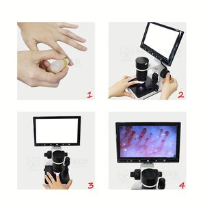 Độ phân giải cao hình ảnh 7-inch LCD kỹ thuật số kính hiển vi vi sinh học USB cho máu hiển thị nailfold mao mạch - Product Image 4