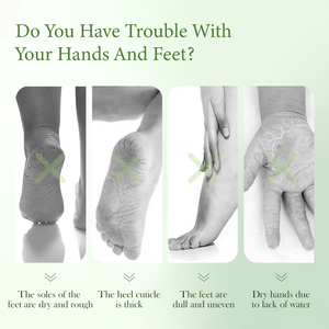 Crème pour les pieds à la vente chaude, crème pour éliminer les fissures des pieds, crème adoucissante pour les pieds, protection à l'huile d'arbre à thé et réduction du gonflement, crème pour les pieds à l'huile d'arbre à thé - Product Image 3