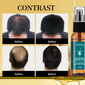 Tratamiento profesional para el cabello para hombres y <span class=keywords><strong>mujeres</strong></span>, suero para la pérdida y el crecimiento del cabello con Spray de jengibre, extrafuerte, uso diario - Product Image 2