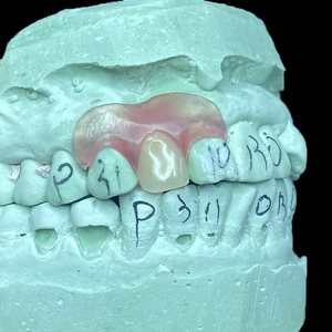 Prothèse <span class=keywords><strong>dentaire</strong></span> partielle amovible en résine flexible, invisible et incassable |   pour les laboratoires ou les cliniques | Fabriqué en Chine - Product Image 6