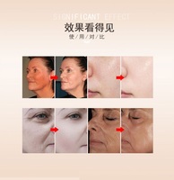 Máquina Profesional de Electroporación, Mesoterapia sin Agujas, Microcorriente Facial, para Salón de Belleza y Spa