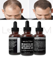 Bloqueur de DHT Repousse Caféine Biotine Qualité Sérum de Croissance Capillaire Huile de Croissance Capillaire Marque Privée Vente en Gros Bio Naturel pour Hommes