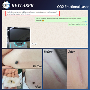 미국 510K RF 튜브 <span class=keywords><strong>Co2</strong></span> 프랙셔널 레이저 10600nm <span class=keywords><strong>Co2</strong></span> 프랙셔널 레이저 기계 흉터 제거용 - Product Image 3