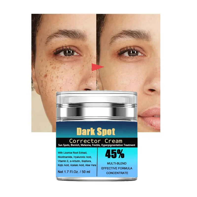 Melasma Freckle Sun Dark Spots Remover For Face Body Armpit Hyperpigmentation Removal Treatment Dark Spot Corrector Cream