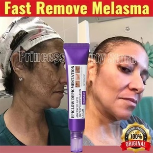 Crème de soins de la peau pour blanchir les taches de rousseur élimination de la pigmentation réparation rapide de la mélanine éclaircir la niacinamide livraison directe - Product Image 3