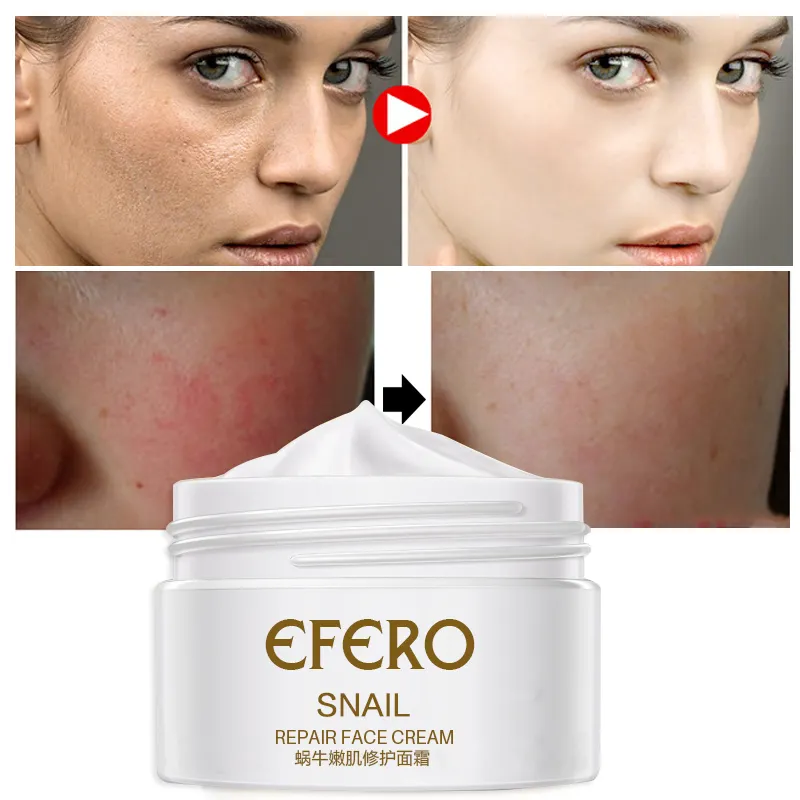 Cuidado de la piel, Anti arrugas, antiedad hidratante nutrición reparación colágeno Efero Caracol blanqueamiento de la piel crema de cara