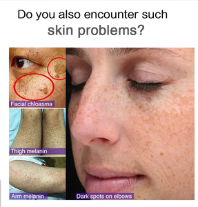 Sueros Más Vendidos, Concentrado de Oro 24K para Aclarar Manchas Oscuras en los Nudillos, Suero Blanqueador <span class=keywords><strong>Puro</strong></span> para el Cuidado de la Piel, para Rostro y Cuerpo, para Mujeres - Product Image 5