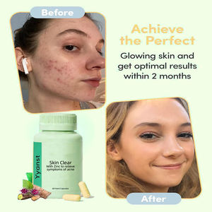 Cápsulas de alta calidad de marca privada con raíz de bardana y vitaminas A, C y B5 para combatir la inflamación de la piel y reparar la barrera cutánea. - Product Image 6