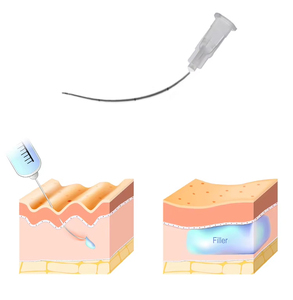 Aiguille hypodermique d'<span class=keywords><strong>acide</strong></span> <span class=keywords><strong>hyaluronique</strong></span> jetable médicale de la CE ISO 25g 50mm aiguille micro de canule de pointe émoussée pour le remplisseur de Derma - Product Image 4