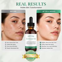 Label privé 15% vitamine C E sérum éclaircissant blanchissant estompe les dommages du soleil soin des taches brunes élimination des imperfections sérum à l'acide férulique