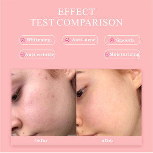 Suero para el cuidado de la piel con vitamina C de ácido hialurónico de alta calidad, proveedores de Corea del Sur, suero para el cuidado de la piel 5 en 1 - Product Image 3