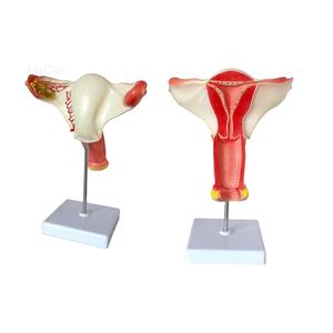 医療外陰部モデル解剖学的女性膣解剖学モデル - Product Image 1