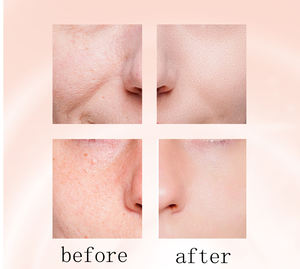 Offre Spéciale effet significatif portable après avoir utilisé une partie plus profonde du sérum anti-âge nourrissant de rétinol de peau - Product Image 5