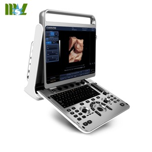 CHISON Ebit50 Medische Echografie-apparaat met <span class=keywords><strong>Trolley</strong></span> Instrumenten MSK Vasculair 4D Digitale <span class=keywords><strong>Trolley</strong></span> Kleuren <span class=keywords><strong>Doppler</strong></span> Echografie - Product Image 4