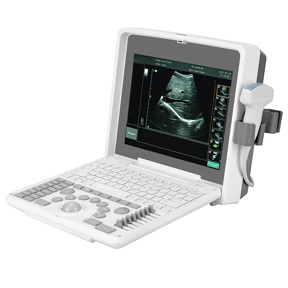 Ziekenhuis-Specifieke Medische Ultrasone Instrumenten Kleur Echografie Machine Voor Veterinaire Behandeling