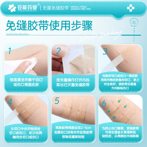 Parche médico Tuoneng sin sutura para reducir la tensión de la piel, para cierre de heridas de cesárea y cuidado de cicatrices infantiles - Product Image 2