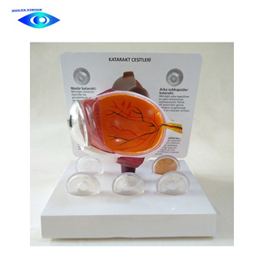 Modelo de ojo humano de catarraco para ciencia médica, modelo de ojo anatómica - Product Image 3
