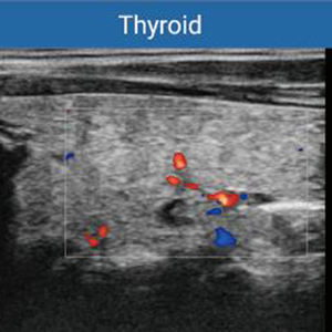 Alat diagnostik ultrasonik warna 3D/4D/5D, pemindai Ultrasound eksklusif portabel, peralatan Ultrasound - Product Image 5