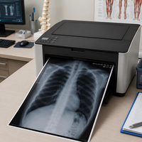 Film Inkjet Medis PET Basis Biru, Film Kering X-ray Transparan, Ukuran A4 A5 A6, Pasokan Grosir