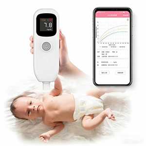 เครื่องวัดบิลิรูบินสำหรับทารกแรกเกิดแบบ OEM เครื่องวัดภาวะตัวเหลืองผ่านผิวหนัง - Product Image 1