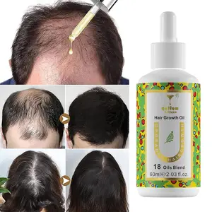 Органические продукты для лечения эфирных масел, частная марка, уход за волосами, лечение выпадения волос для роста волос, мужчин и женщин