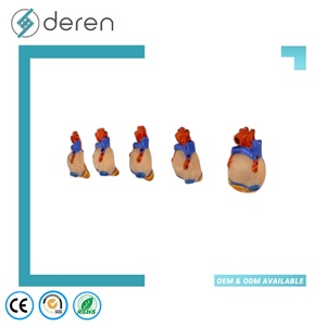 Model Penyakit Jantung Bawaan Model Demonstrasi Anatomi Jantung Patologis - Product Image 6